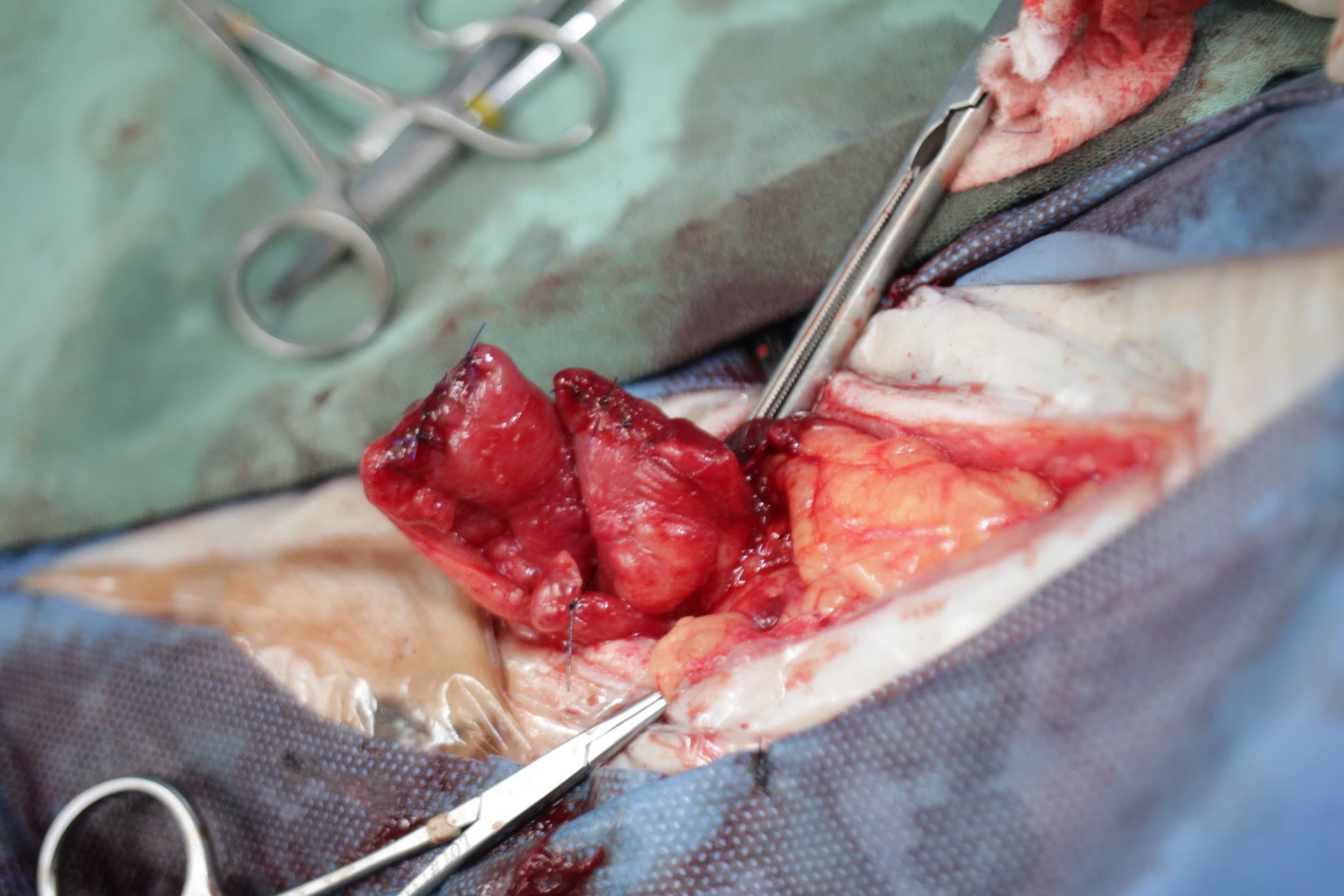 リンパの細胞検査 顕微鏡写真